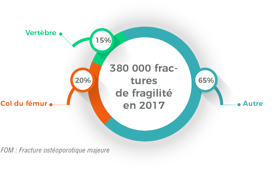 Fractures de fragilité en 2017